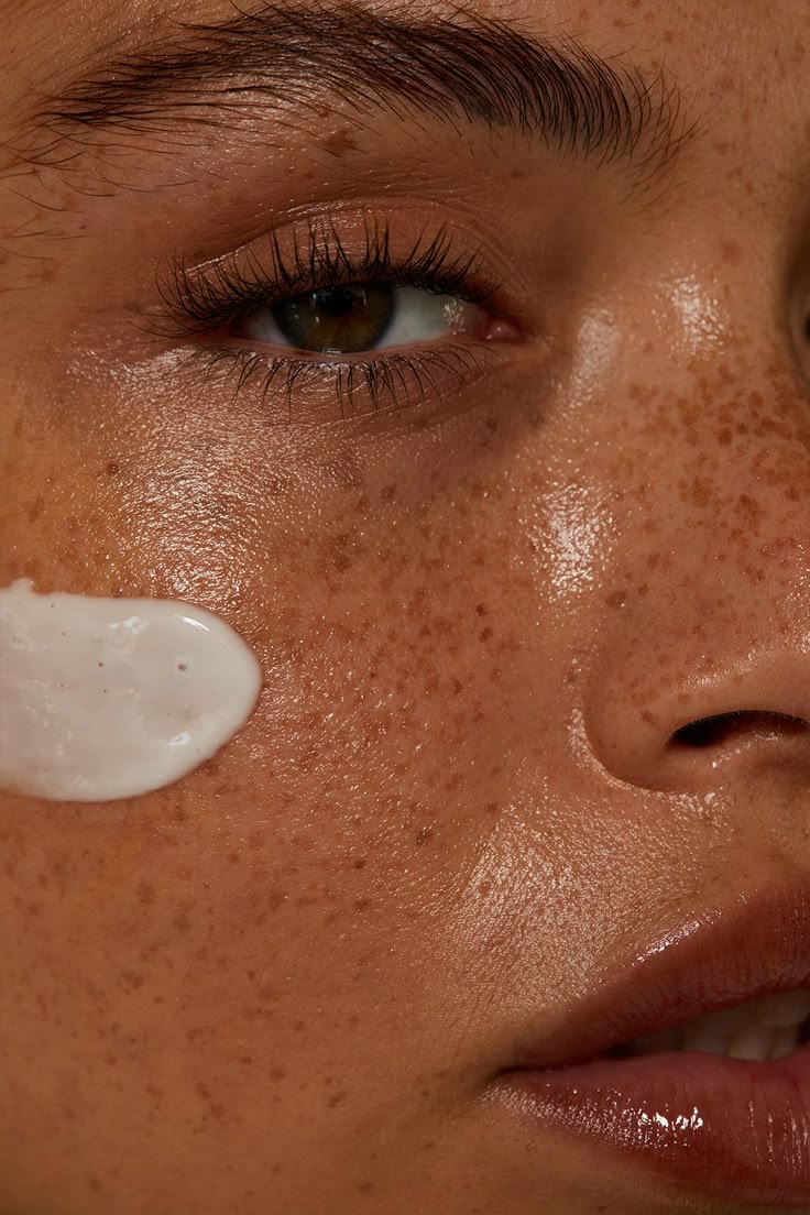Causes of Hyperpigmentation
